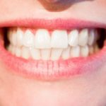 Piękne zdrowe zęby również olśniewający cudny uśmieszek to powód do zadowolenia.